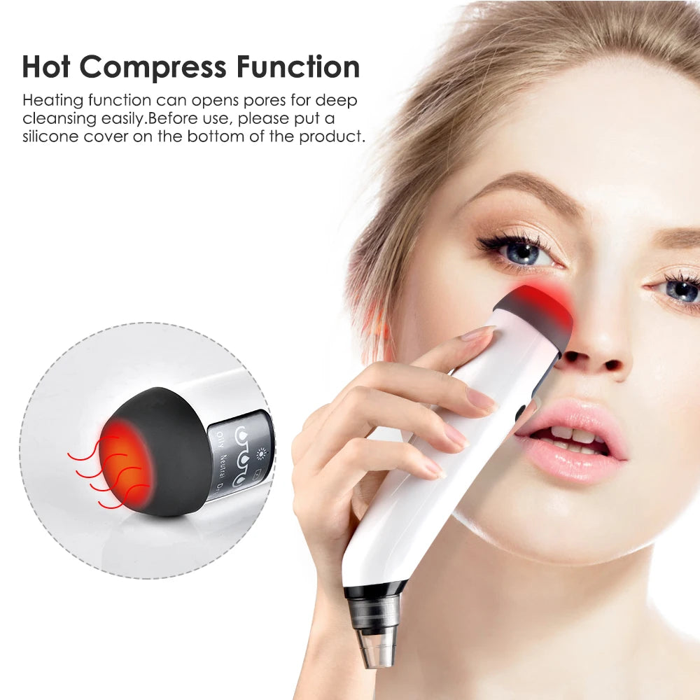 Electric Blackhead Remover – Deep Facial Vacuum Cleansing Device
