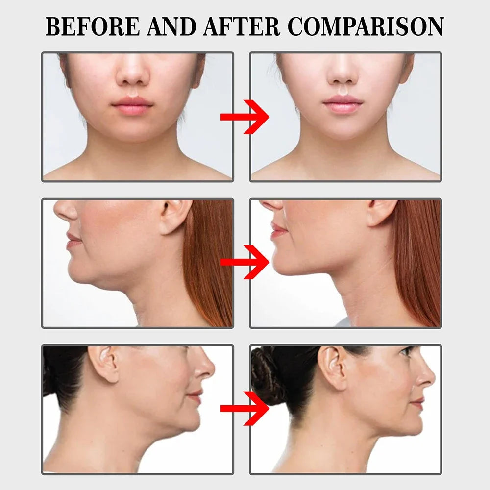 Bandes adhésives liftantes pour le visage – Raffermissement instantané de la peau du visage et du cou