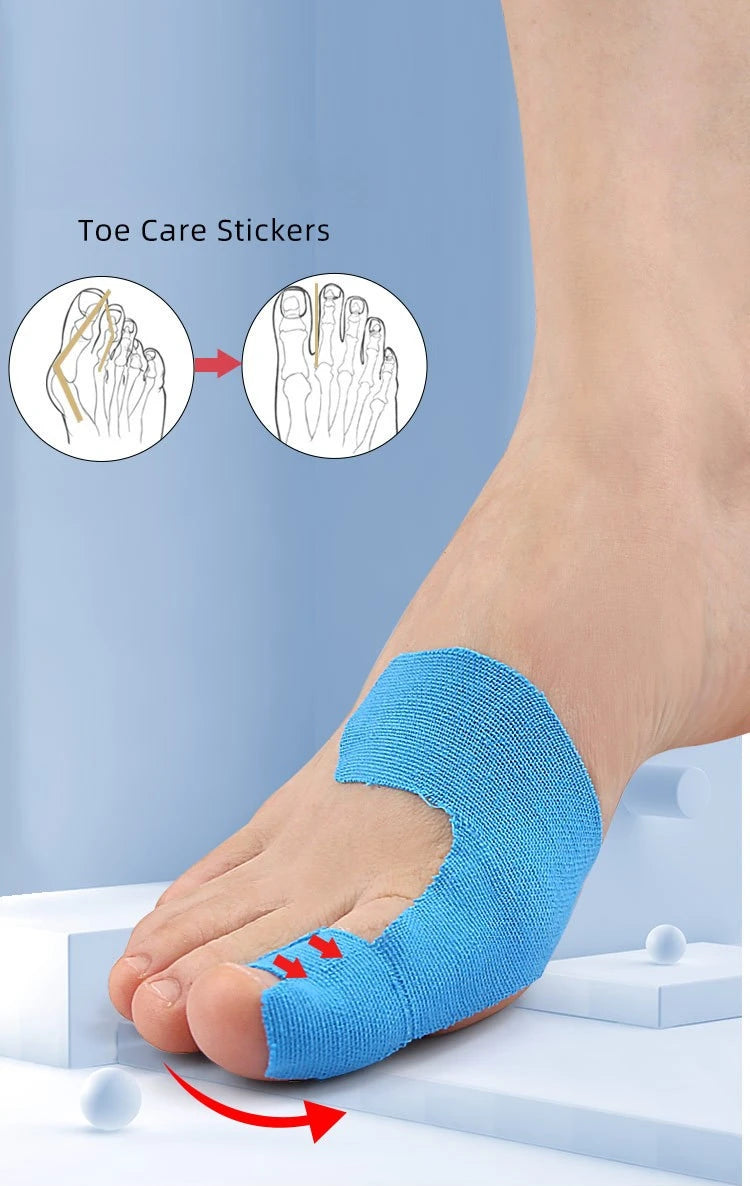 Verpakking van 10 tapes voor de correctie van hallux valgus (bunion) – hypoallergeen en latexvrij