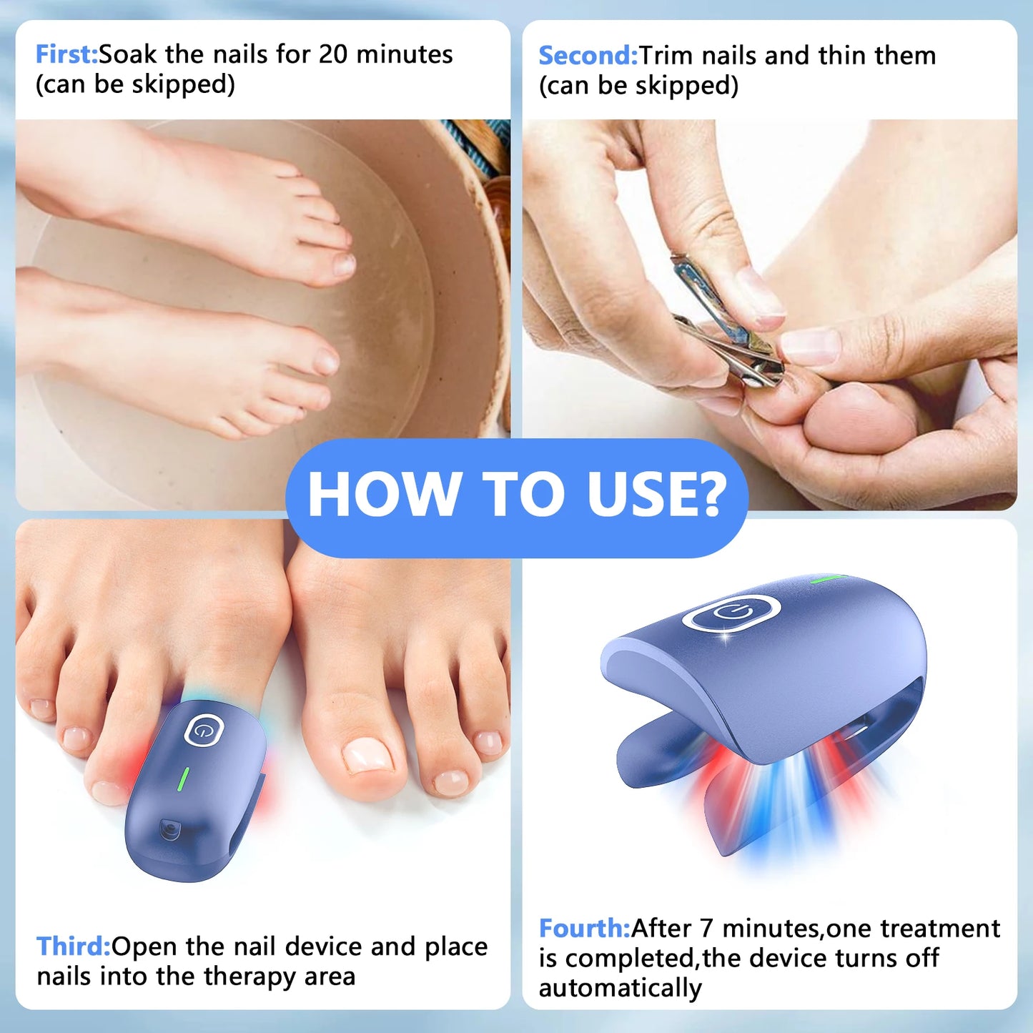 Nail Fungus Laser Device – Toenail Fungus Remover