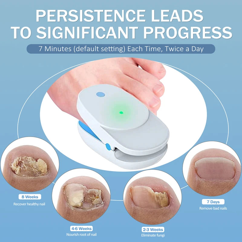 Appareil laser pour l'élimination des mycoses des ongles des orteils et des doigts