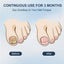 48W Laser Nail Fungus Treatment Device – Blue & Infrared Light