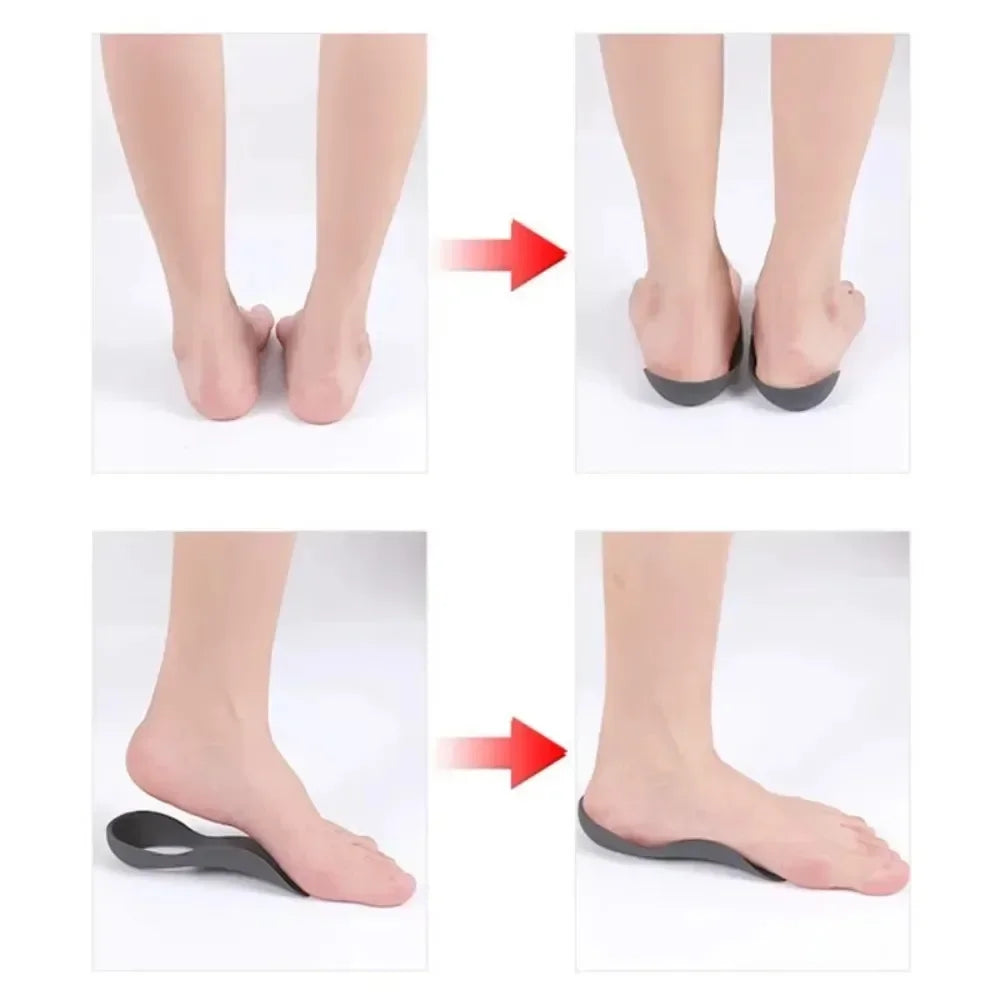 Orthotic Arch Support Insoles – Flat Feet & Plantar Fasciitis Relief