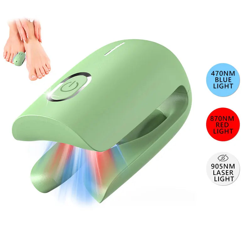 Laserbehandelingsapparaat voor nagelschimmel – Blauw, Rood & Pulserend Licht