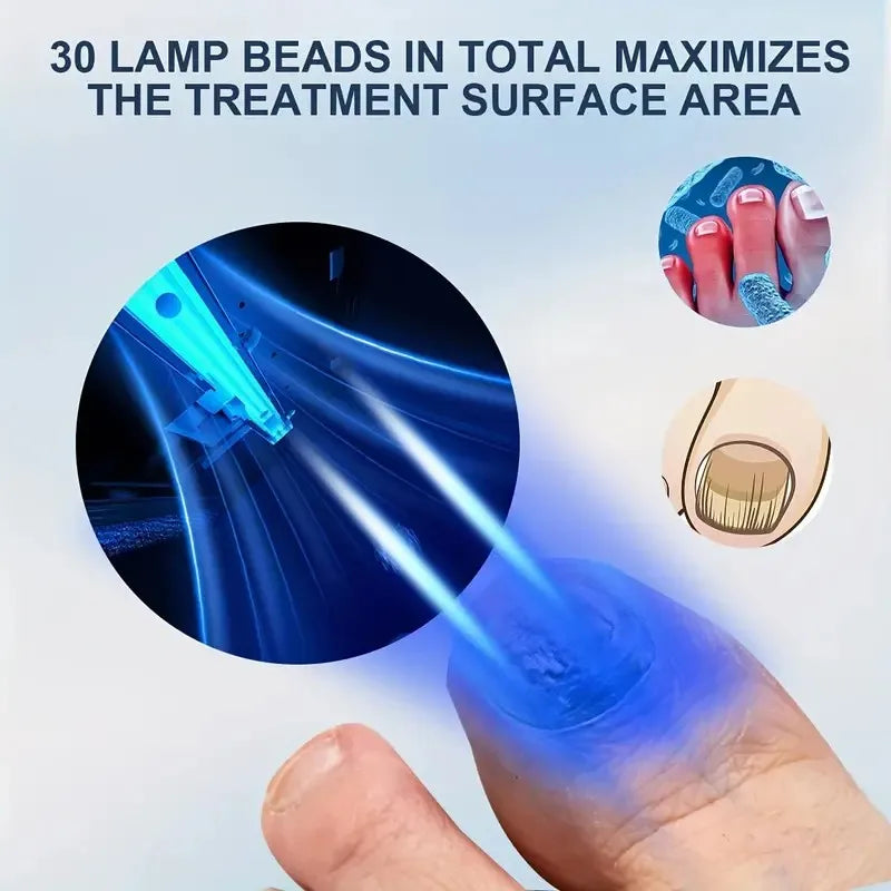48W Laser Nail Fungus Treatment Device – Blue & Infrared Light