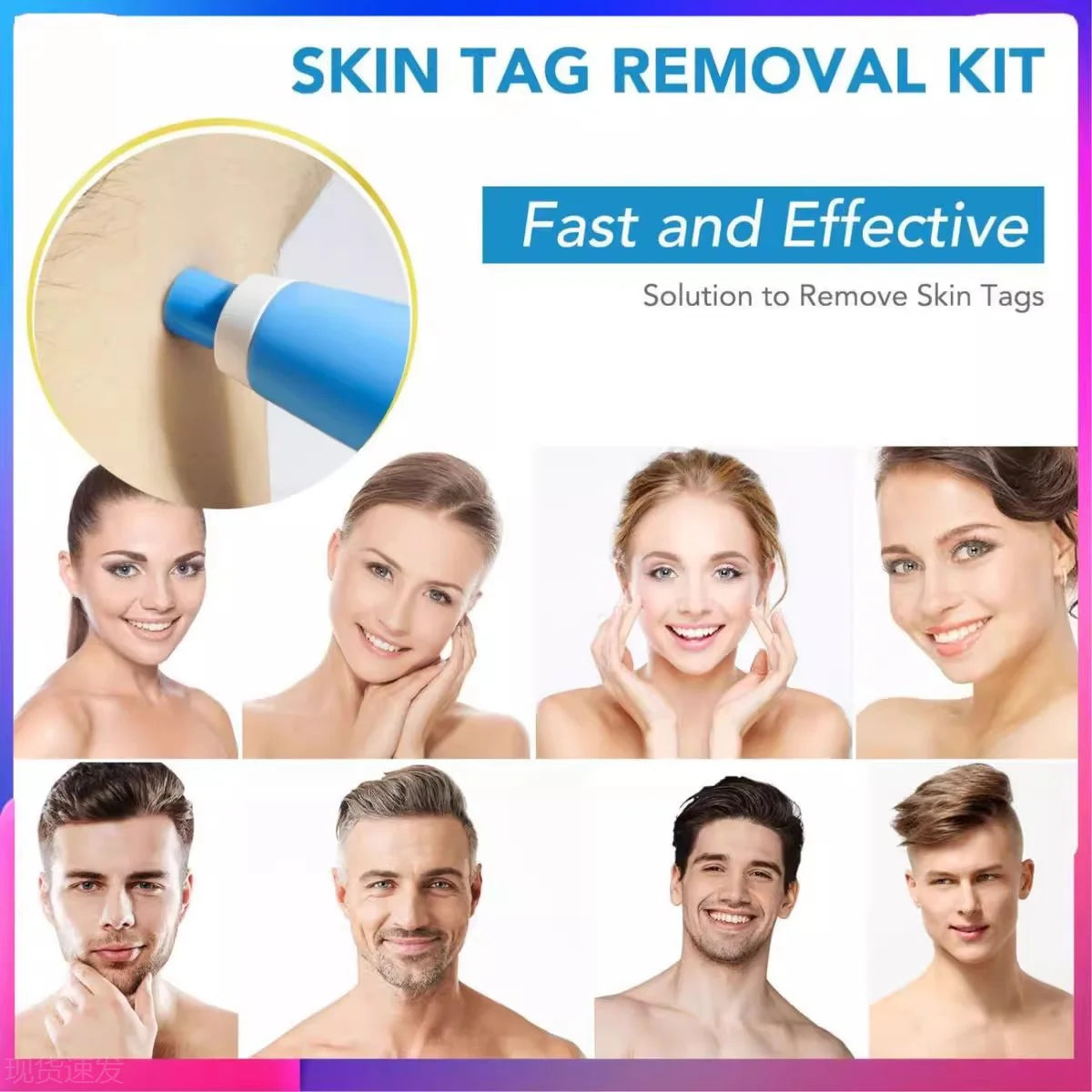 2-in-1 Face Mole Removal Tool Kit – Skin Tag & Wart Remover