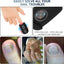 Laserbehandelingsapparaat voor nagelschimmel – Blauw, Rood & Pulserend Licht