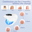 Wireless Nail Fungus Treatment Laser – Blue Light