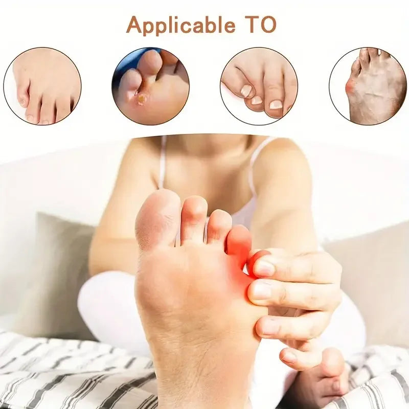 Toe Alignment Corrector – Silicone Gel Separators  Anti-Slip Strap