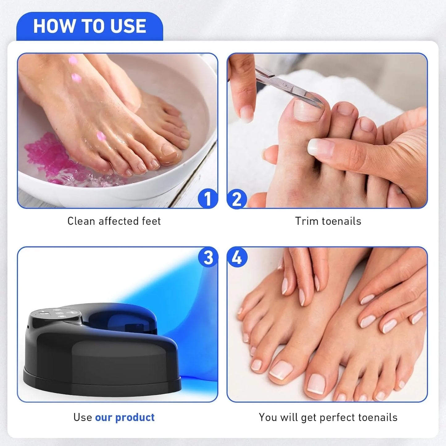 Appareil de traitement sans fil des mycoses des ongles au laser – Lumière bleue et infrarouge 45 W