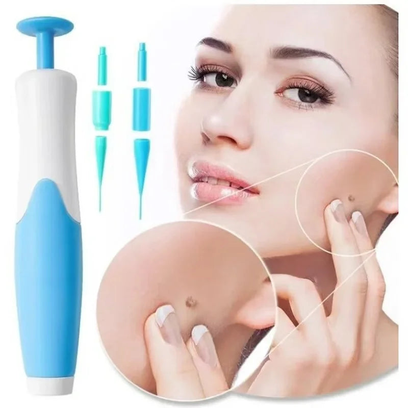 2-in-1 Face Mole Removal Tool Kit – Skin Tag & Wart Remover