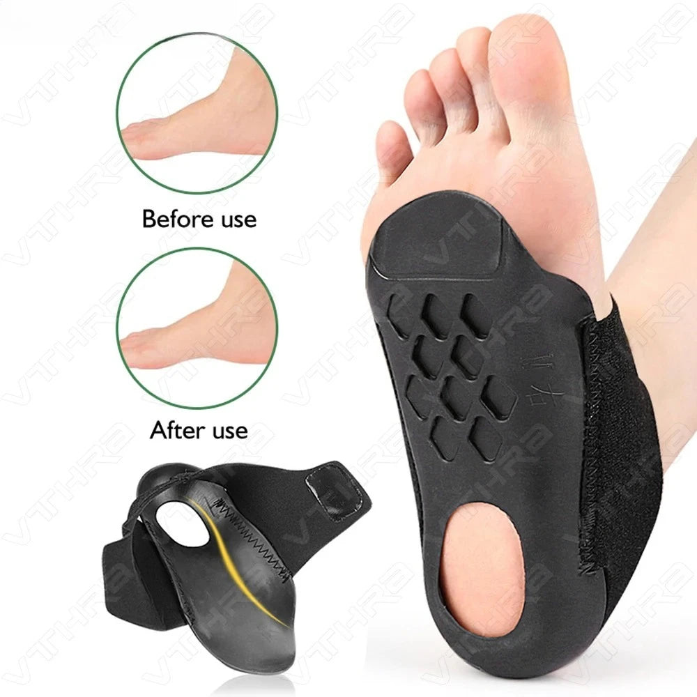1 paire de chaussettes de soutien de la voûte plantaire en gel – Coussinets élastiques