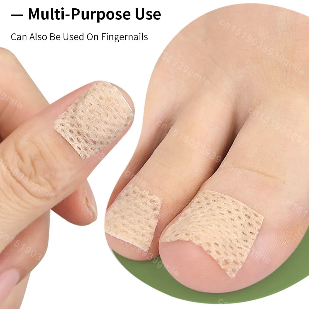 Patchs réparateurs pour ongles d'orteils (10 pièces) – Soutien pour les ongles incarnés et abîmés