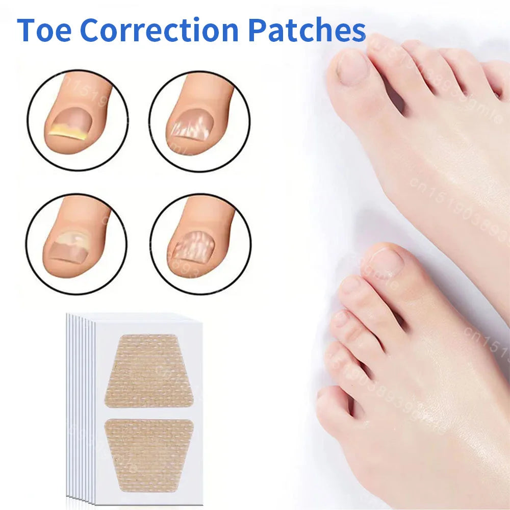 Patchs réparateurs pour ongles d'orteils (10 pièces) – Soutien pour les ongles incarnés et abîmés