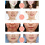 Set van 2 4D V-vormige hydrogel gezichtsmaskers voor een liftend effect – afslankend en verstevigend