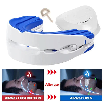 Anti-Snoring Mouthpiece – Adjustable Night Guard