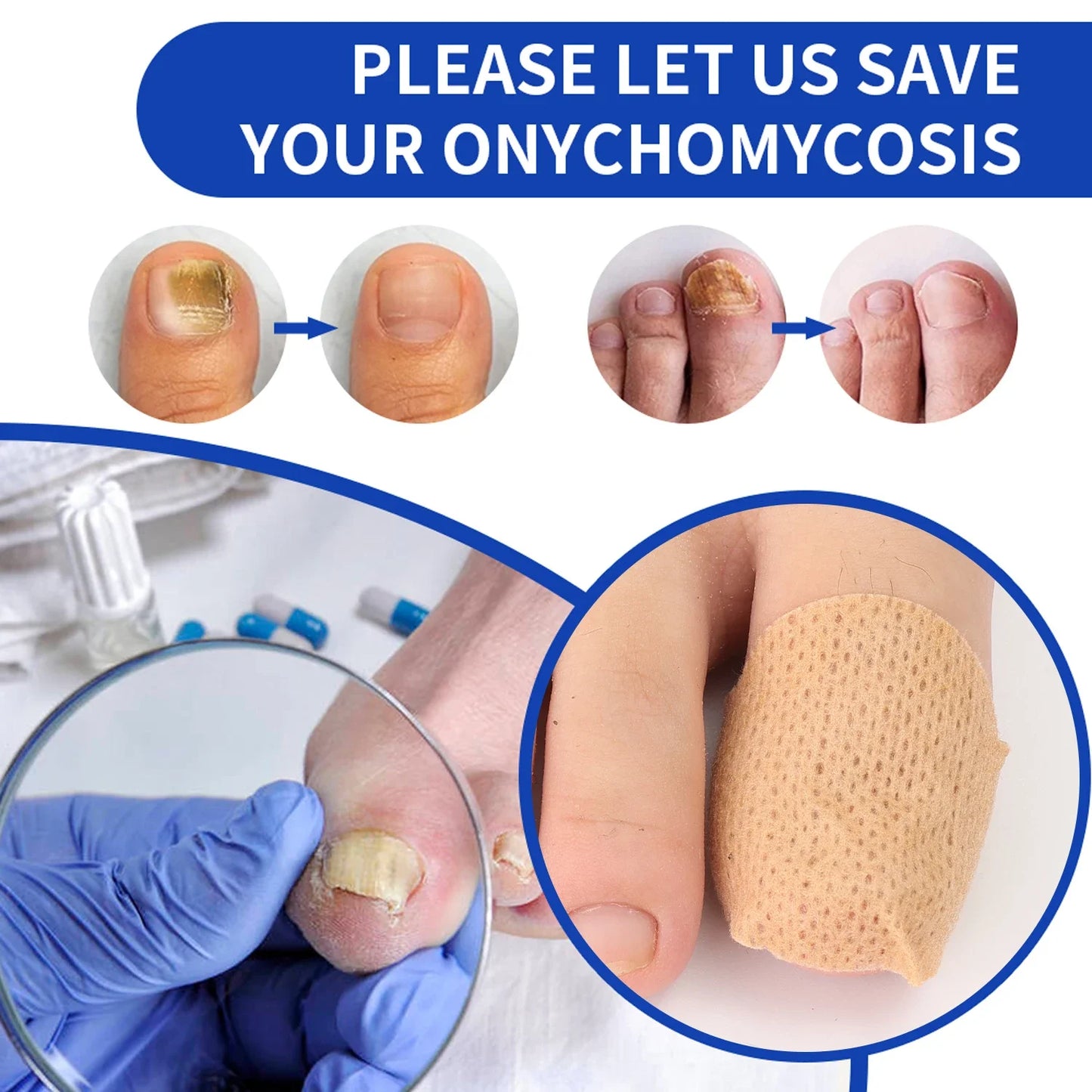 Nail Fungus & Ingrown Toenail Patch – Waterproof Foot Repair