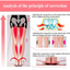 Siliconen orthopedische inlegzolen voor O/X-benen – Verlichting van valgus- en varuspijn