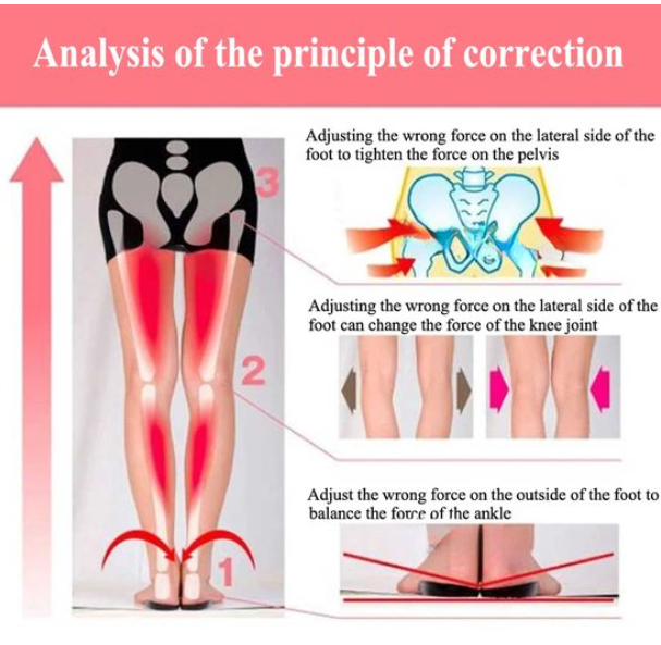 Siliconen orthopedische inlegzolen voor O/X-benen – Verlichting van valgus- en varuspijn