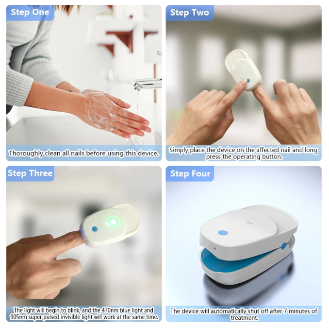 Appareil laser pour l'élimination des mycoses des ongles des orteils et des doigts