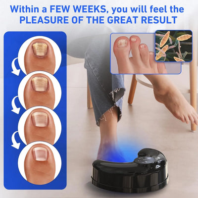 Appareil de traitement sans fil des mycoses des ongles au laser – Lumière bleue et infrarouge 45 W