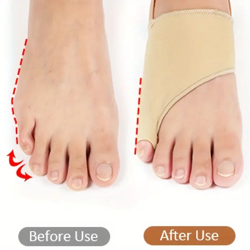 Toe Alignment Corrector – Silicone Gel Separators  Anti-Slip Strap