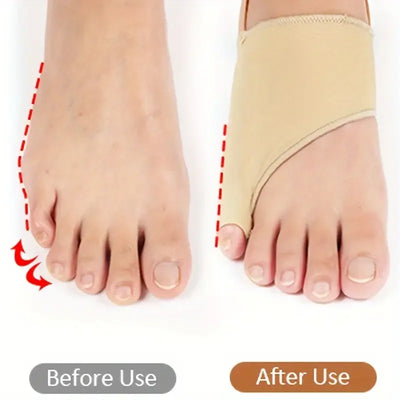 Toe Alignment Corrector – Silicone Gel Separators  Anti-Slip Strap