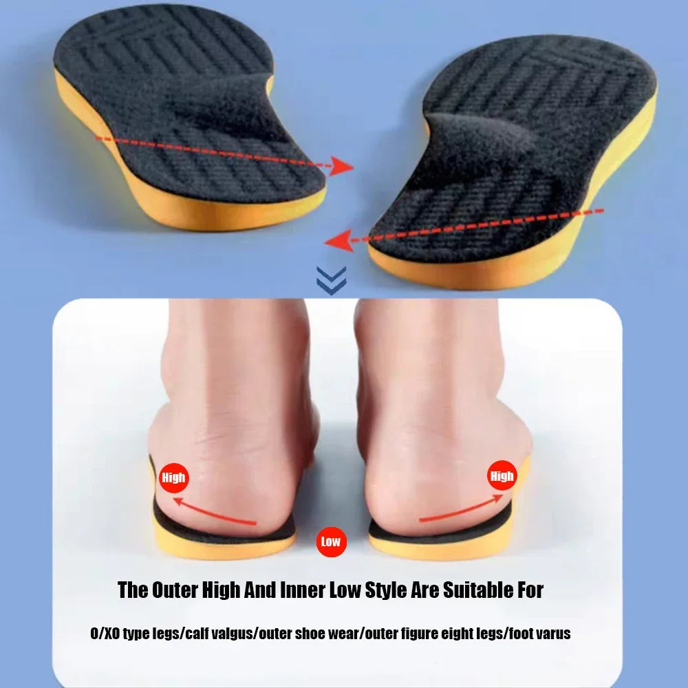 Semelles orthopédiques pour pieds plats 2025 – Soutien de la voûte plantaire et alignement des jambes