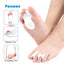 Gel Teen Spreiders & Voorvoetkussens – Hallux Valgus Teen Corrector