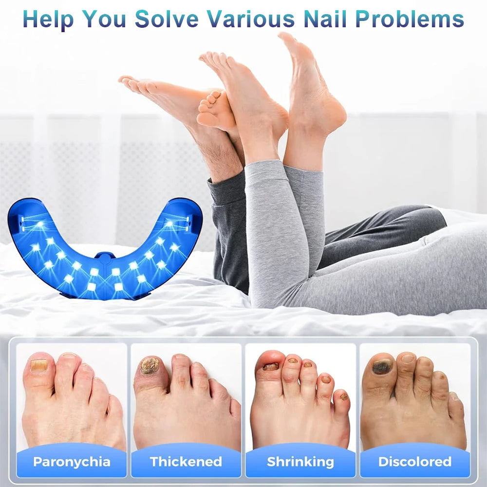 Laser Nail Care Pen – Quick & Painless Nail Renewal Device